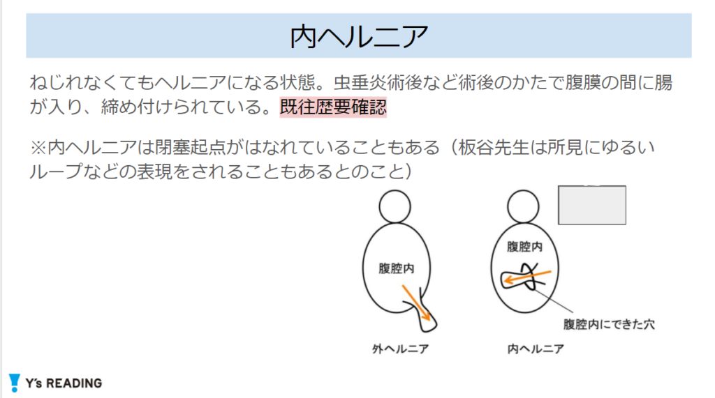 イレウス 絞 扼性